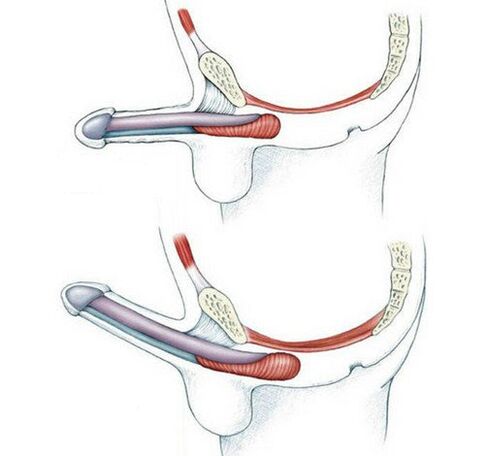 Penis ouni Training de Pubococytus Muskel an duerno